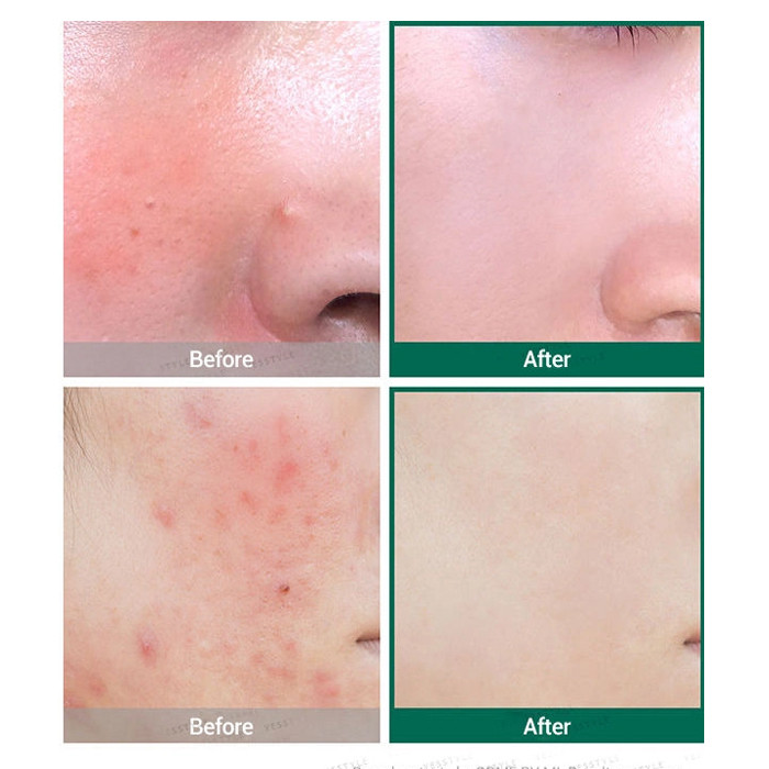 SOME BY MI Aha.Bha.Pha 30Days Miracle Serum 50ml-SAREN-STORE.IR