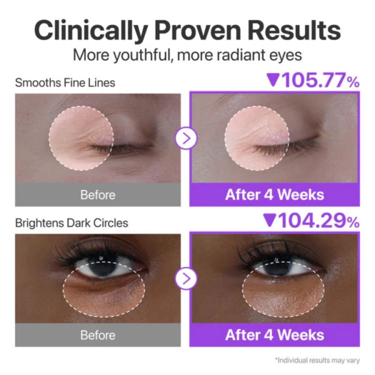 umbuzin NAD Retinol Volumetox Eye Cream-saren-store.ir